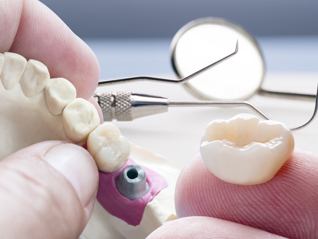 Life Dental Spa